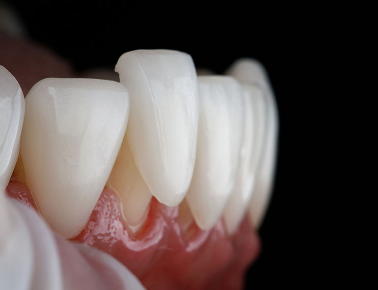 Strengthen and protect teeth: